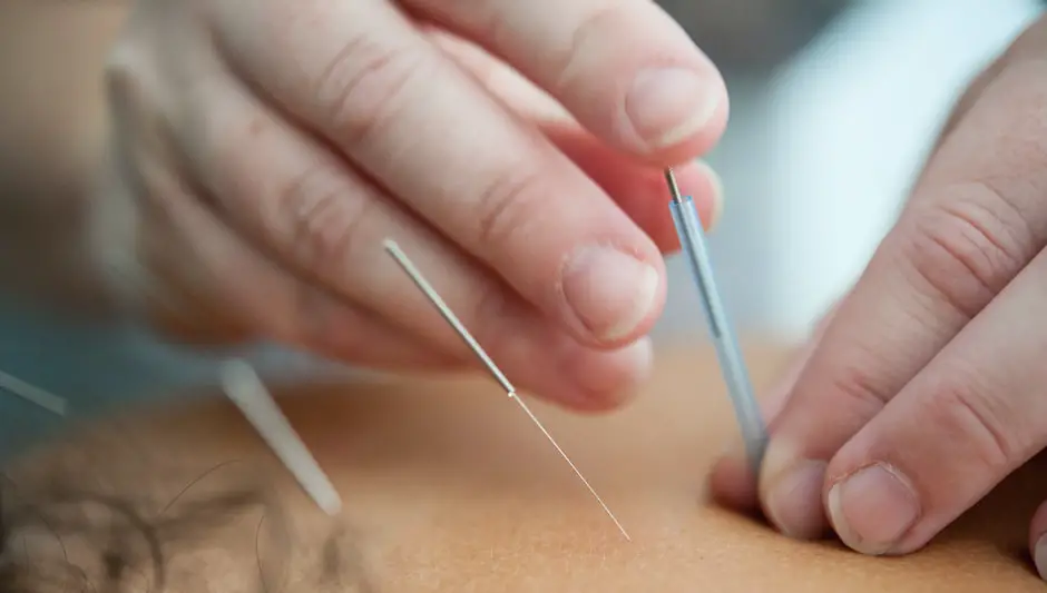can acupuncture help with bladder problems
